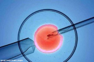 一般不妊検査・タイミング療法